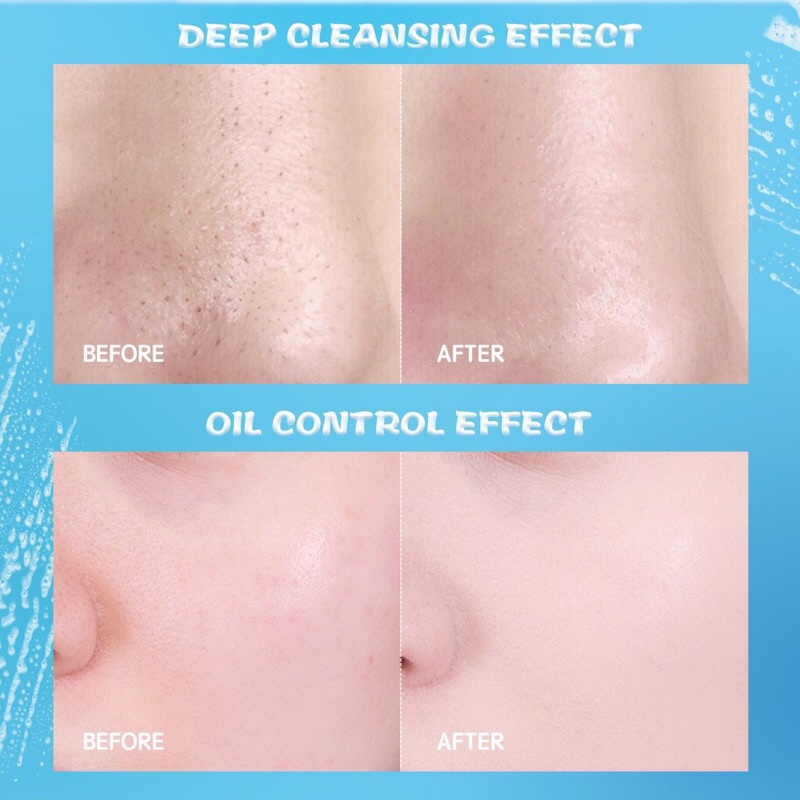 YOU Hy! Amino Contr-Oil Oil Control Facial Wash 50gr (Biru) YOU Hy! Amino Contr-Oil Oil Control Facial Wash 50gr (Biru)